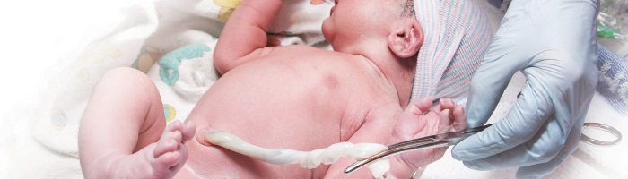 About Delayed Cord Clamping